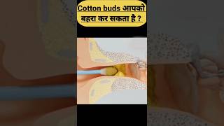 Cotton buds से आपके कान का पर्दा फट सकता है, जिससे आप बहरे हो सकते है #shorts