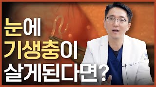 공원을 산책하다가 눈에 기생충이 생길 수 있다?