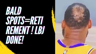 CAN LAKERS WIN WITH BALD SPOT LEBRON JAMES? DEION SANDER LOSES RB DYLAN EDWARDS & MORE! #viral #lbj