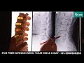 जानिये रीढ़ की हड्डी में गैप क्यों आता है कैसे करें इलाज gap in spinal cord causes u0026 treatment