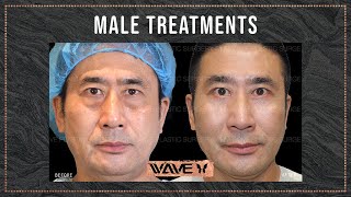 Male Plastic Surgery: The 3 Most Popular Cosmetic Procedures fro Men | Wave Plastic Surgery