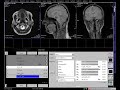 mri application training brain without contrast