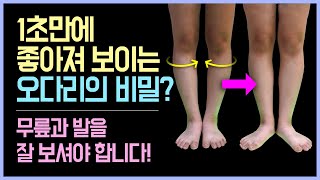 1초 만에 좋아져 보이는 오다리의 비밀?