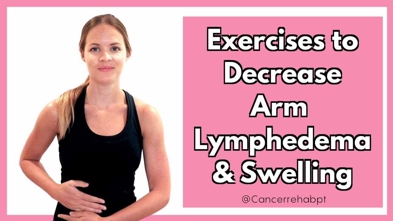 Exercises For Arm Lymphedema - To Help Reduce Arm Swelling Or Hand ...