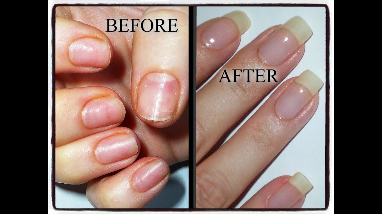 My Nail Journey-Growing Natural Nails After Damage From Acrylics/Gels ...