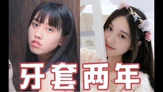 【管管】戴牙套两年，我究竟经历了什么？