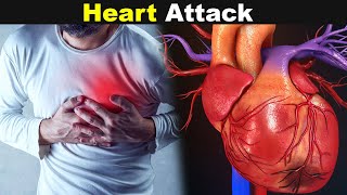 Heart Attack (Mayocardial Infarction) | Symptoms,Causes And Treatments (Urdu/Hindi)