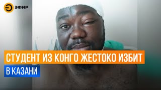 26-летний студент из Конго был избит компанией парней