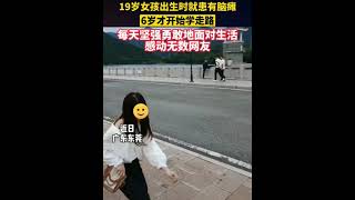 19岁脑瘫女孩勇敢面对生活感动无数网友，加油小姑娘！