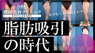 【値下げ】アキーセル脂肪吸引が今、アツい！内出血などのダウンタイムを抑える秘訣とは！？#29