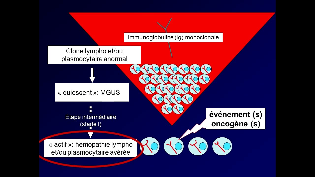 Gammapathie_monoclonale_de_signification_rénale_:_ Jean-Paul_ FERNAND ...