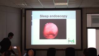 Sleep endoscopy - Rosario Marchese-Ragona (GSID Sleep day 2018)