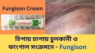 Fungison Cream চিপায় চাপায় চুলকানী ও ফাঙ্গাল সংক্রমনে দ্রুত কার্যকরী এন্টি ফাঙ্গাল ক্রীম । বিস্তারিত