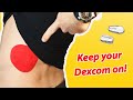 5 Steps to Protect your Dexcom CGM 🟠 How to apply a Dexcom PATCH