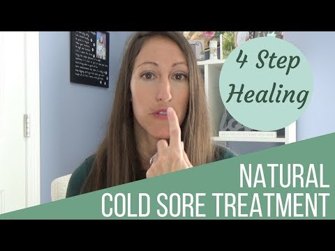 4 Natural Ways to Heal a Cold Sore & Cure Herpes Simplex Virus 1 & 2 Fast & Naturally! 4 Natural Ways to Heal a Cold Sore & Cure Herpes Simplex Virus 1 & 2 Fast & Naturally!