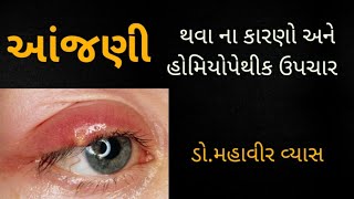 આંજણી : Stye : થવા ના કારણો અને હોમિયોપેથીક ઉપચાર : ડૉ.મહાવીર વ્યાસ