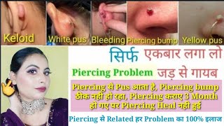 Piercing bumps गायब करने का आसान व घरेलू उपाय ll Piercing से Related हर Problem का आसान इलाज ll