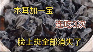 The Magic of Wood Ear Mushrooms:3 Times for Amazing Results! 木耳加一寶，輕鬆擁有健康肌膚和黑髮 Transform Your Health