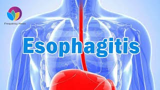 Esophagitis RIfe Healing Frequency丨Cleanse Esophagus Naturally & Relieve Acid Reflux