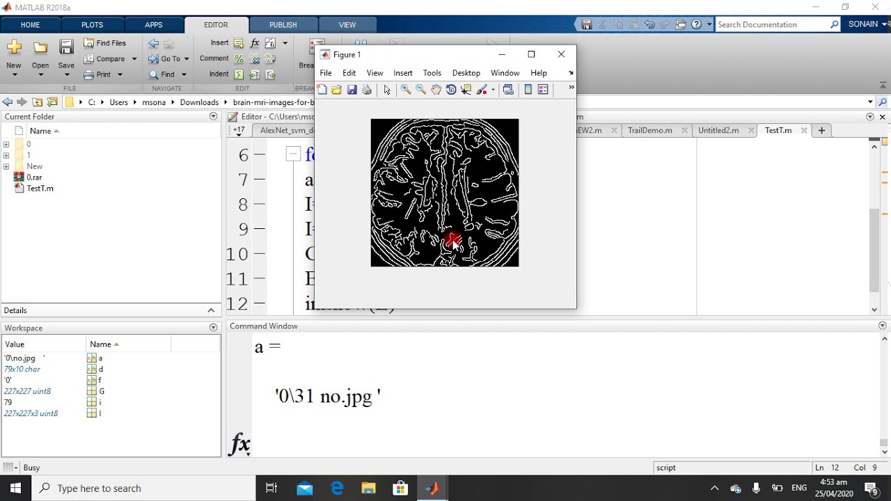 Edge Detection With MATLAB - YouTube