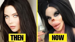40 Most Shocking Celebrity Plastic Surgery Disasters 2026 Update