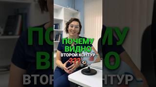 Двоение при астигматизме. Двоение или второй контур.