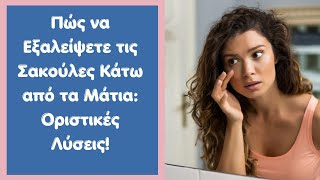 Πώς να Εξαλείψετε τις Σακούλες Κάτω από τα Μάτια: Οριστικές Λύσεις!