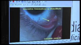 GlobalMed TotalExam™ Ophthalmic Telemedicine Exam