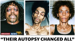 10 Shocking Autopsy Revelations From R&B Legends’ Deaths