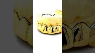 8pc 18k Gold Top Grillz in Seattle | Seattle Gold Grills