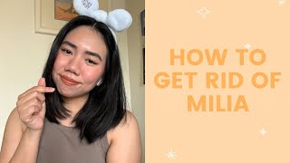 How to Get Rid of Milia | FaceTory