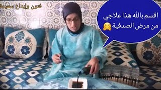 لن يخطر ببالك ان علاجي النهائي من الصدفية 100/100  هي زيت السيارات المحروقة