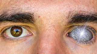 I GOT A CHROME EYE!