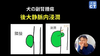 犬の副腎腫瘍　後大静脈内浸潤シルエットサイン