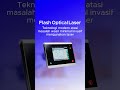 Flash Optical Laser Metode Tindakan Wasir Minimal Invasi #wasir #ambeien #fyp #fypシ゚viral