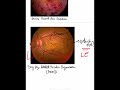 How to identify which eye based on fundus photo? #Basics #Shorts