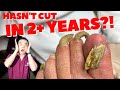 CUTTING AND GRINDING DOWN LONG THICK NAILS (SUPER CRUNCHY!!) | Dr. Kim, Kim Foot and Ankle