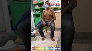 CUPPING FOR BODY PAIN | #bodypain #cupping #shorts #shortsvideo