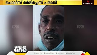 ഉത്സവത്തിനിടെ പൊലീസ് മർദിച്ച് മൂന്ന് പല്ലുപോയി; പരാതിയുമായി തൃശൂർ എളവള്ളി സ്വദേശി