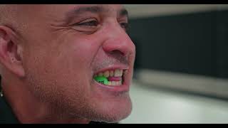NAP 5DS Universal & Mid Profile Mouthpiece Fitting Instructions