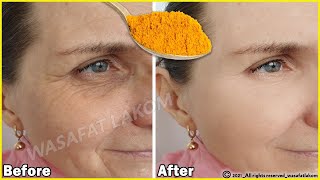 Even if you are 70, 🌹 apply it to wrinkles, it will make your face taut like glass / Stronger botox