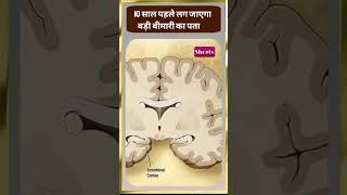 10साल पहले लग जाएगा     बड़ी बीमारी का पताll JanTvBharatwarsh #news #viral #trending #health #shorts