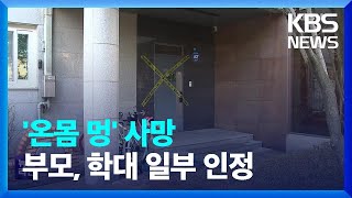 ‘온몸 멍’ 초등생 사망…친부·계모 아동학대 혐의 체포 / KBS  2023.02.08.