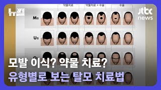 [뉴썰] 탈모 스트레스 '한 가닥 희망'…모발 이식 vs 약물 치료 장단점은? / JTBC News