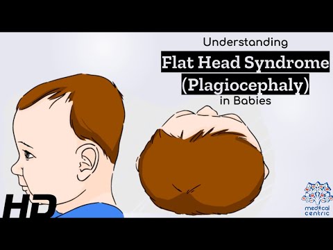 Does flat head affect brain development?
