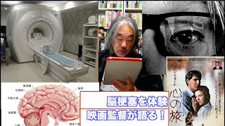 （再）脳梗塞を体験😭ー映画監督が語るーどんな病気？まわりの対応は？