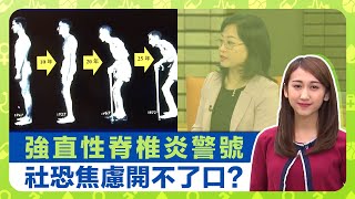 健康360 TVB｜強直性脊椎炎食藥30年腎衰竭 陳柏滔醫生提醒背痛、僵硬警號｜社恐焦慮開不了口? 莊勁怡醫生分享社交恐懼症個案｜中醫治療坐骨神經痛痺症｜最強生命線 曾曉婷