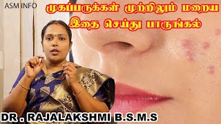 முகப்பருவை மறைய எளிய வீட்டு  வைத்தியம்| Pimples | கரும்புள்ளிகள் நீங்க|Dr.Rajalakshmi | ASM INFO