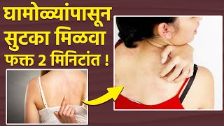 घामोळ्यांनी त्रस्त आहात ? मग करा हे घरगुती उपाय | How to Get Rid of Heat Rash | Heat Rash Treatment