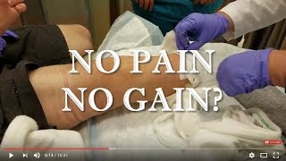 Episode 23: 2nd Post-Opt Doctor Visit \u0026 Night Full Of Pain 10/27/2016